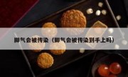 脚气会被传染（脚气会被传染到手上吗）