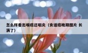 怎么样看出喉癌还咽炎（食道癌晚期图片 长满了）