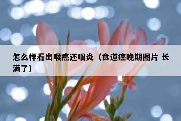 怎么样看出喉癌还咽炎(食道癌晚期图片 长满了) 第1张 怎么样看出喉癌还咽炎(食道癌晚期图片 长满了) 第1张